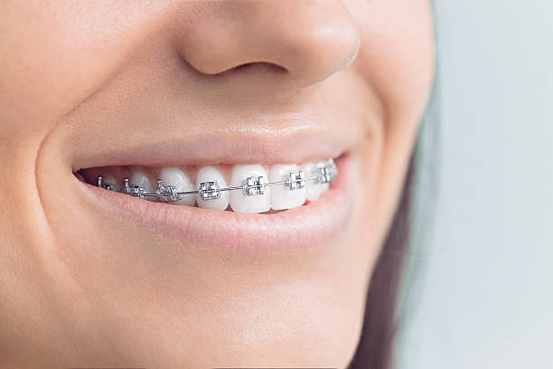 Best Traditional Braces  in Vander, NC